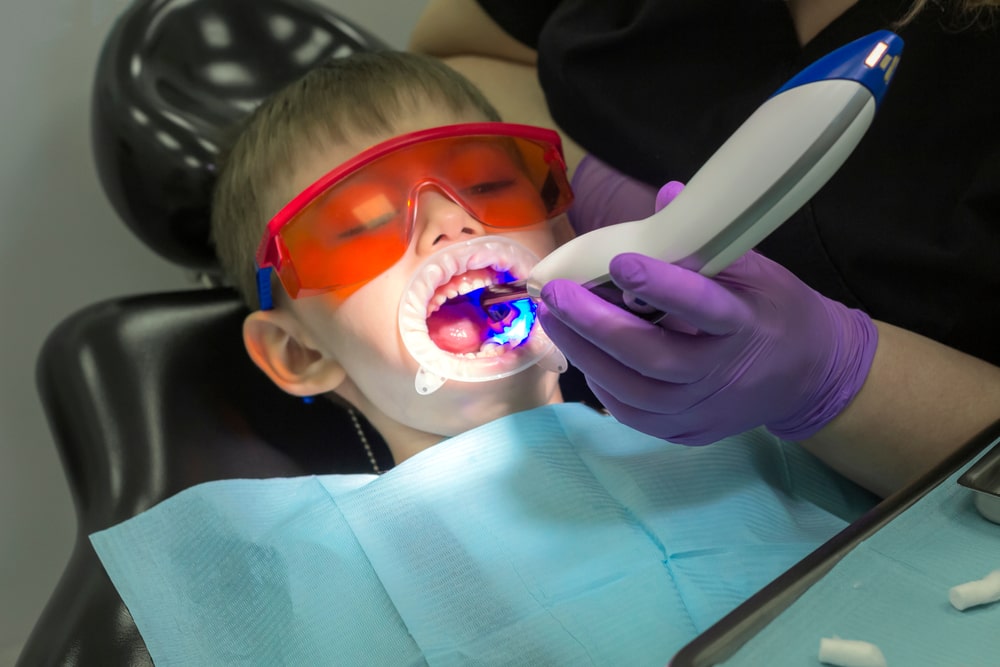 lazer dental treatment 